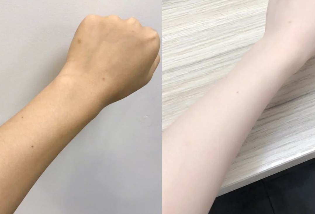怎样美白皮肤 一般人我不告诉他